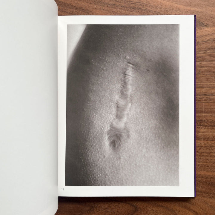 Scars by Miyako Ishiuchi - Tipi bookshop