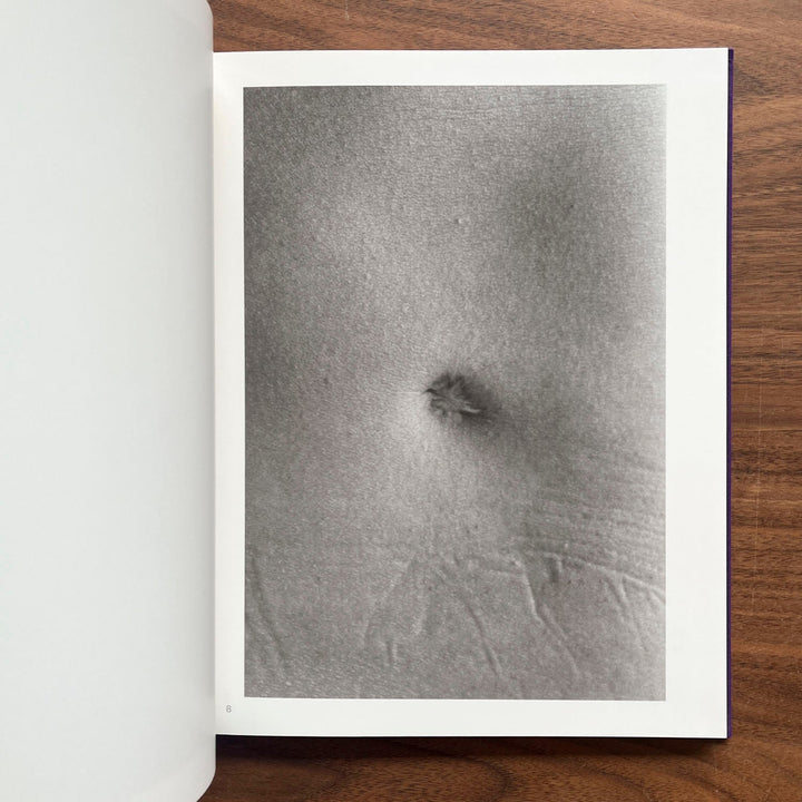 Scars by Miyako Ishiuchi - Tipi bookshop