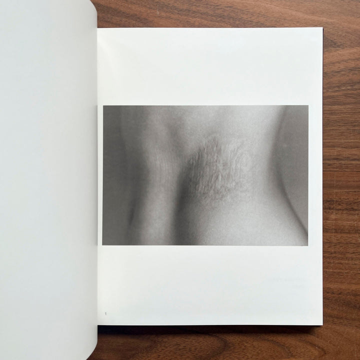 Scars by Miyako Ishiuchi - Tipi bookshop
