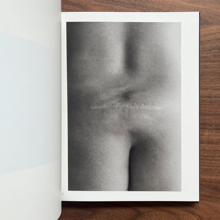 Scars by Miyako Ishiuchi - Tipi bookshop