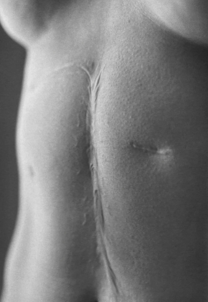 Scars by Miyako Ishiuchi - Tipi bookshop