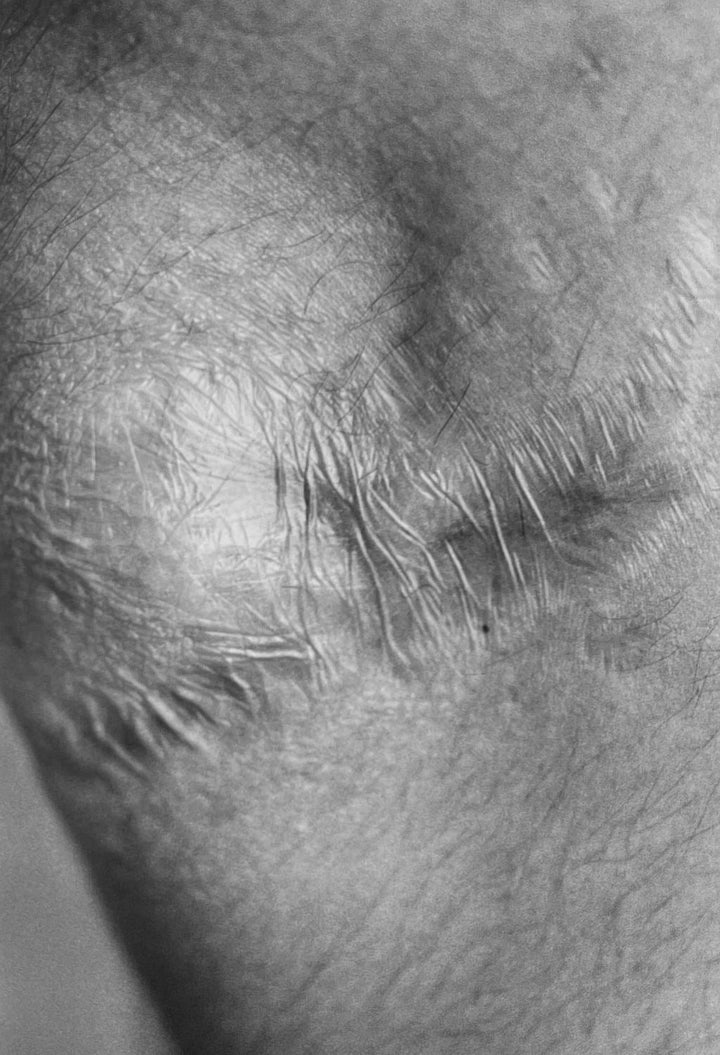 Scars by Miyako Ishiuchi - Tipi bookshop