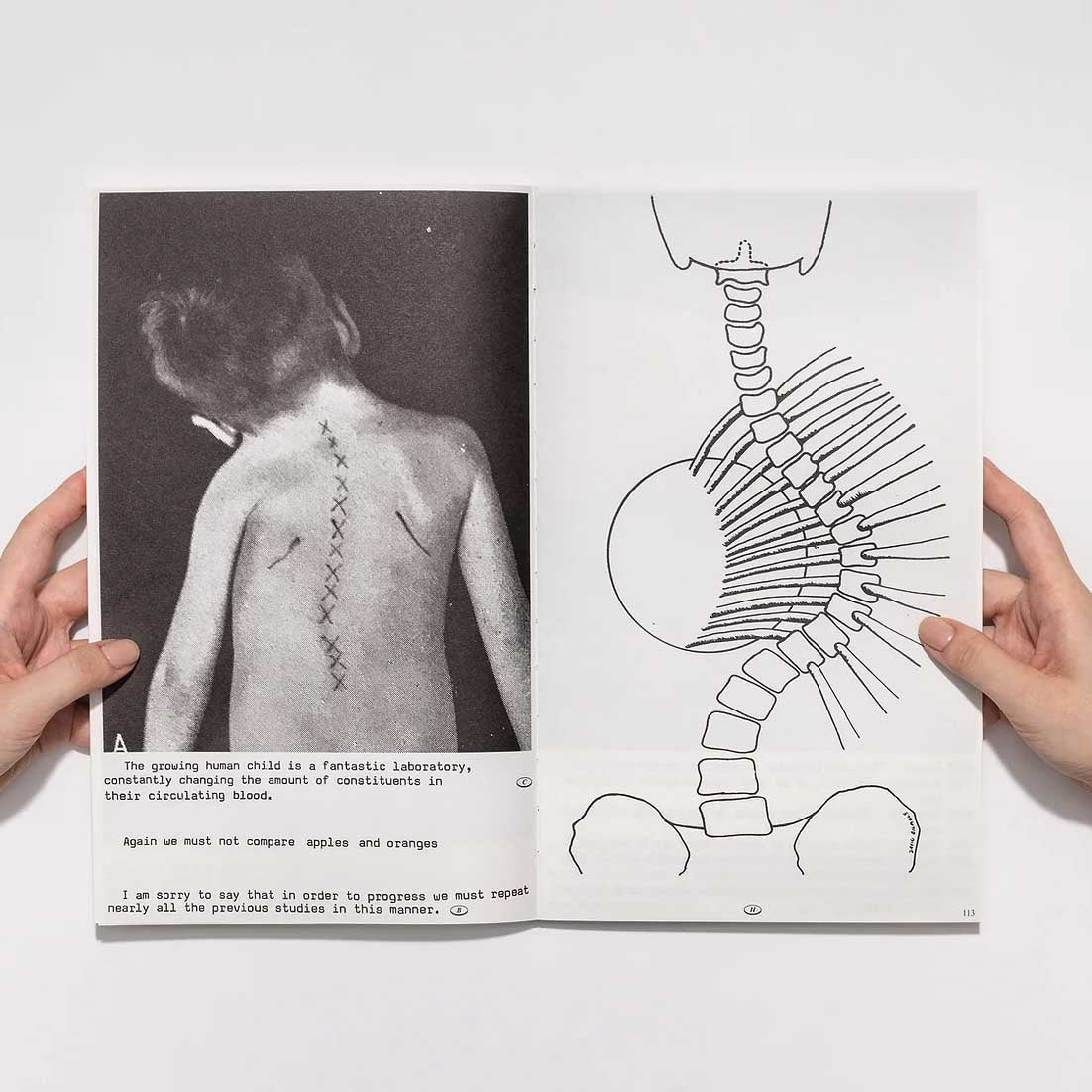 Rules for Photographing a Scoliotic Patient by Woong Soak Teng - Tipi bookshop